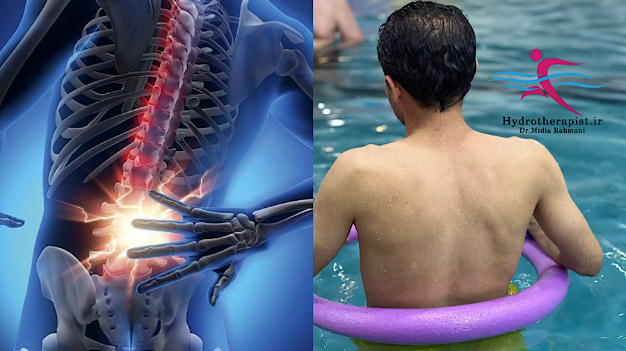 تأثیر آب‌درمانی بر بیماران مبتلا به تنگی کانال نخاعی: یک مطالعه مروری